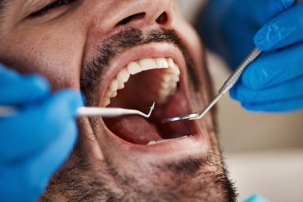 Best Knocked-Out Tooth Emergency  in Farmingdale, NY